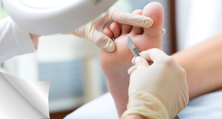 Tretman medicinskog pedikira u profesionalnom podološkom centru